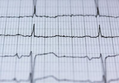 pexels-pixabay-415779 pexels-pixabay-415779